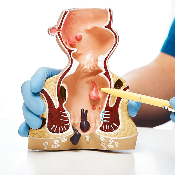Proctology